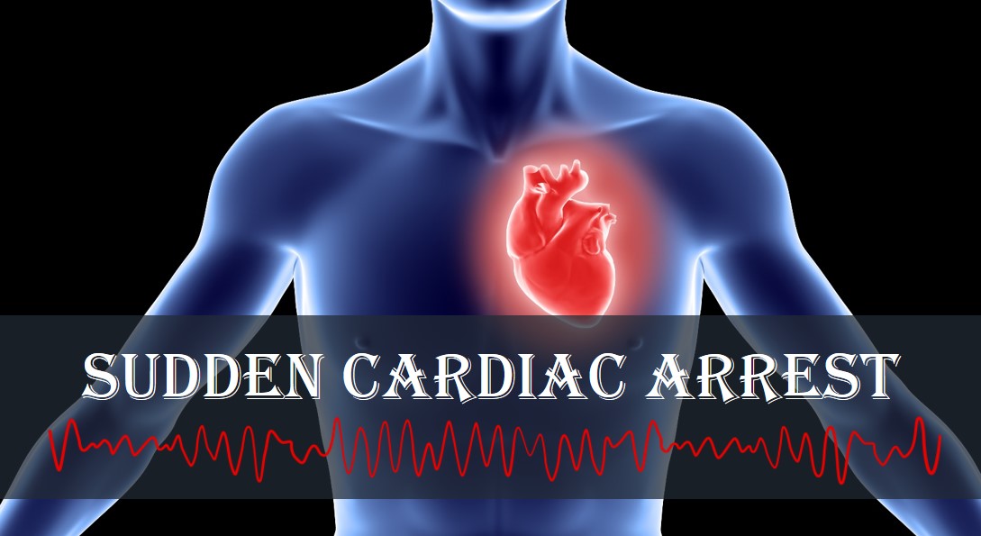 sudden-cardiac-arrest