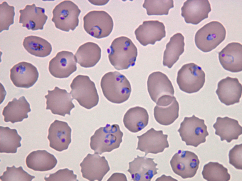 Plasmodium Falciparum Malaria