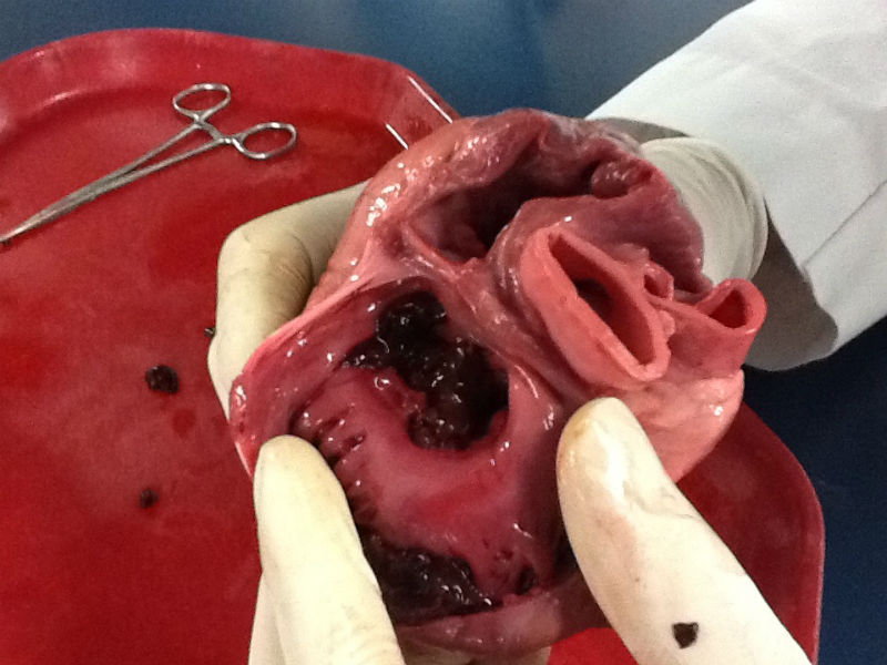 3D Heart Tissue