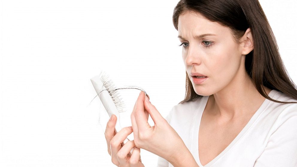 Hair loss can be prevented by applying natural products
