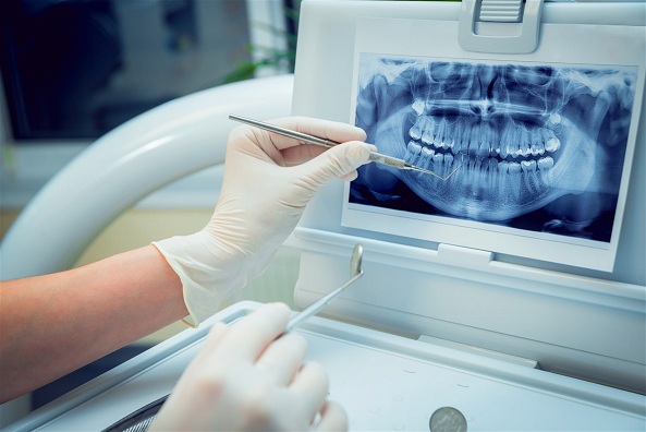 Dental Imaging Market Clinical Analysis and Global Research 2019-2026