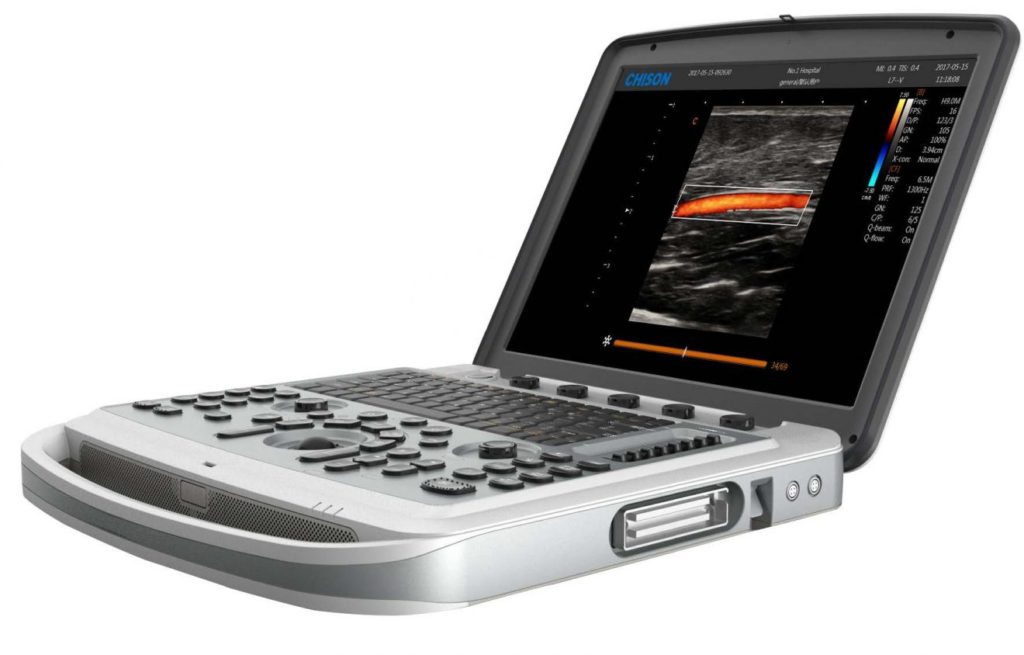Global Portable Ultrasound Device Market: Industry Analysis and Forecast (2017-2026)