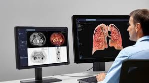 Global Cardiovascular Information System Market – Industry Analysis and forecast (2018-2026)