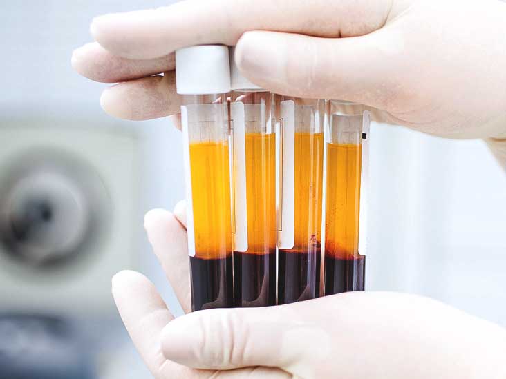 Global Platelet Rich Plasma Market – Global Industry Analysis and Forecast (2018-2026)