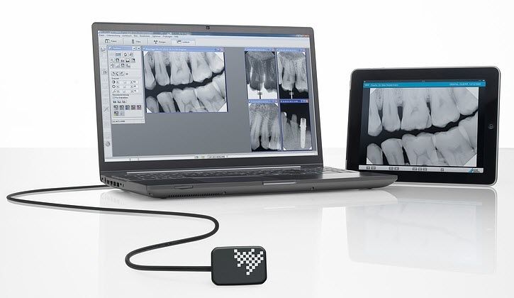 Dental digital X-ray