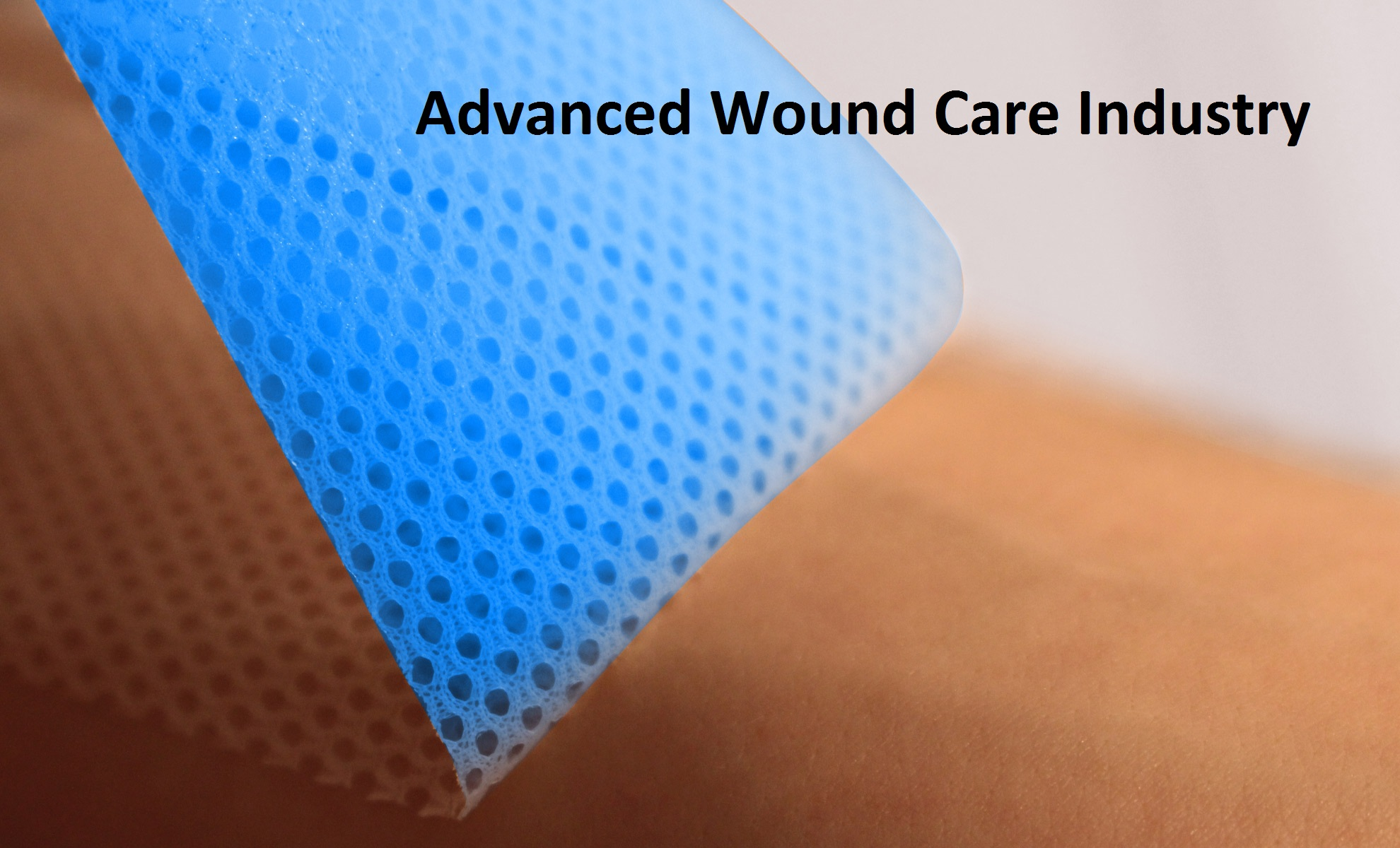  Advanced Wound Care And Closure Market Growth, Business Scope and Global Demand 2019 to 2025 : Smith and Nephew, Kinetic Concepts, 3M, BSN medical