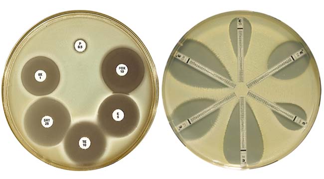 Antimicrobial Susceptibility Testing Market – Global Industry Analysis and Forecast (2017-2026)