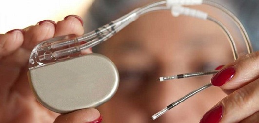 Cardiac Pacemakers Market Global Industry Analysis and Forecast (2018-2026)