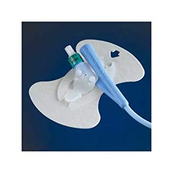 Catheter Securement Device Market 2019 Precise Outlook – Conatec, M. C. Johnson Company, Medtronic, Merit Medical Systems