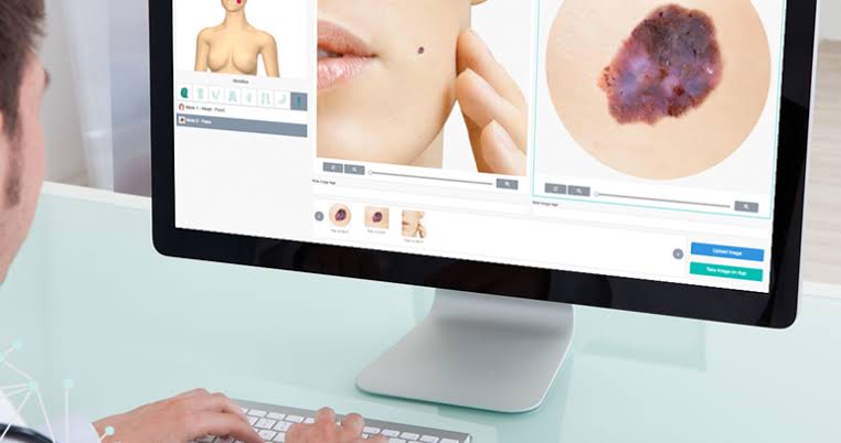 Dermatology Software Market Segment by Regions, Applications, Product Types and Analysis by Growth and Forecast To 2026
