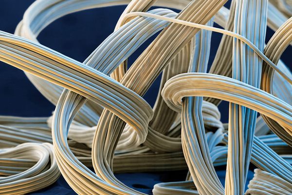  Global Fiber Intermediates Market Strategics Key Players 2019 2025 