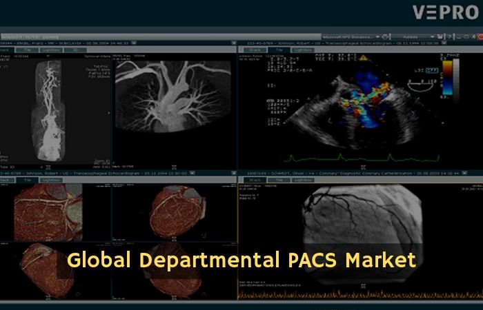 Departmental PACS Market to 2026 scrutinized in new research including leading players Like Acuo Technologies (U.S.), Agfa-Gevaert Group (Belgium), BridgeHead Software Ltd. (U.K.), Carestream Health (U.S.)
