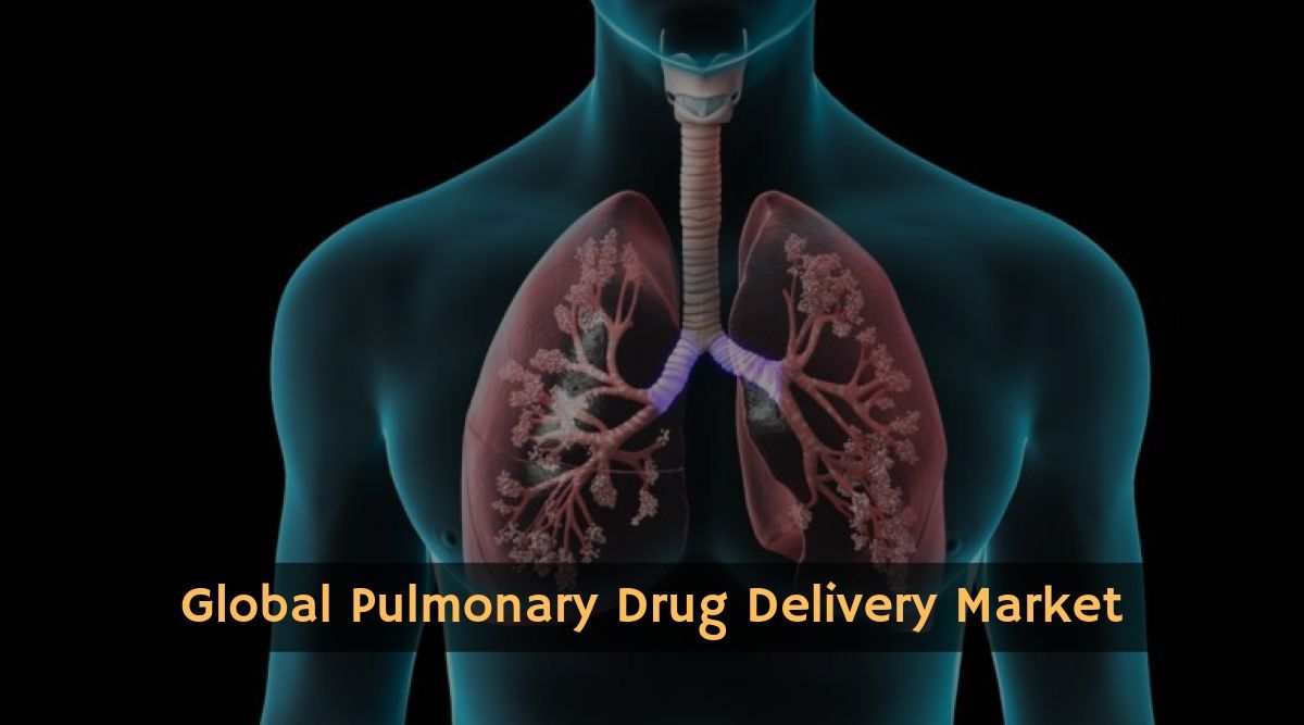 Pulmonary Drug Delivery Market to Represent Significant Revenue Growth by 2024 | Top Players- GlaxoSmithKline plc, 3M, AstraZeneca, Boehringer Ingelheim GmbH