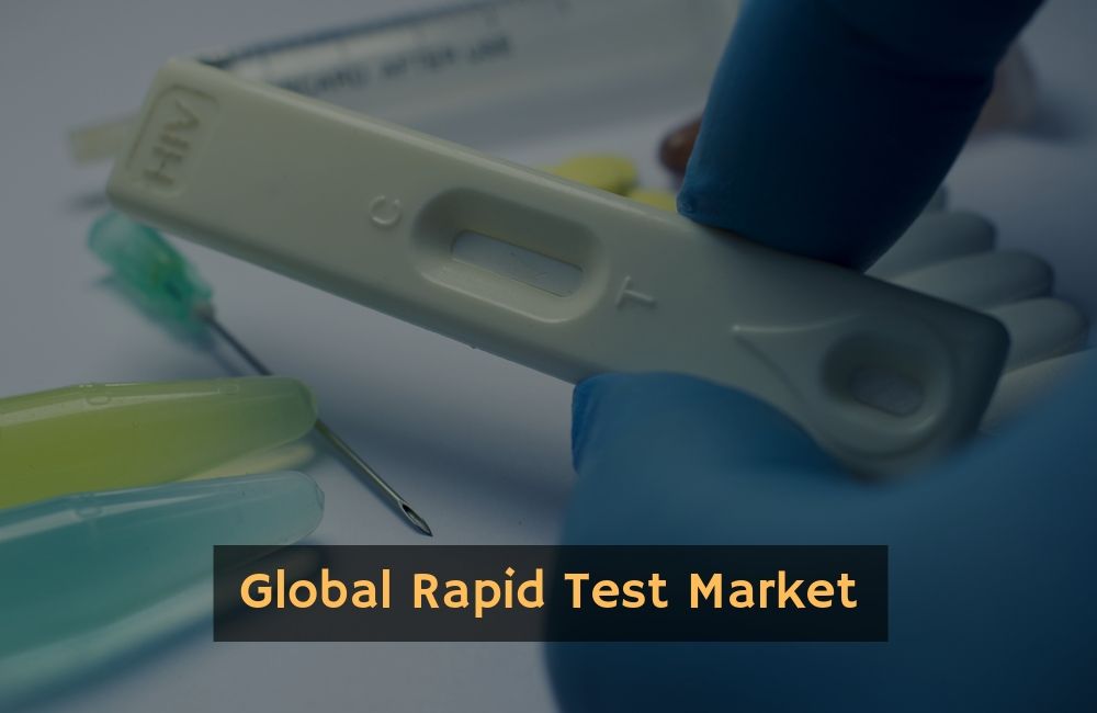 Rapid Test Market 2019 with Recent Trends, Revenue, Demand and Top Manufactures- Bureau Veritas, SGS SA, Intertek Group plc, Eurofins Scientific