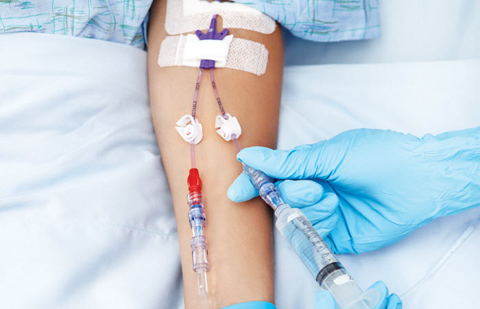 Intravenous (IV) Therapy And Vein Access Market Growth and Analysis 2019