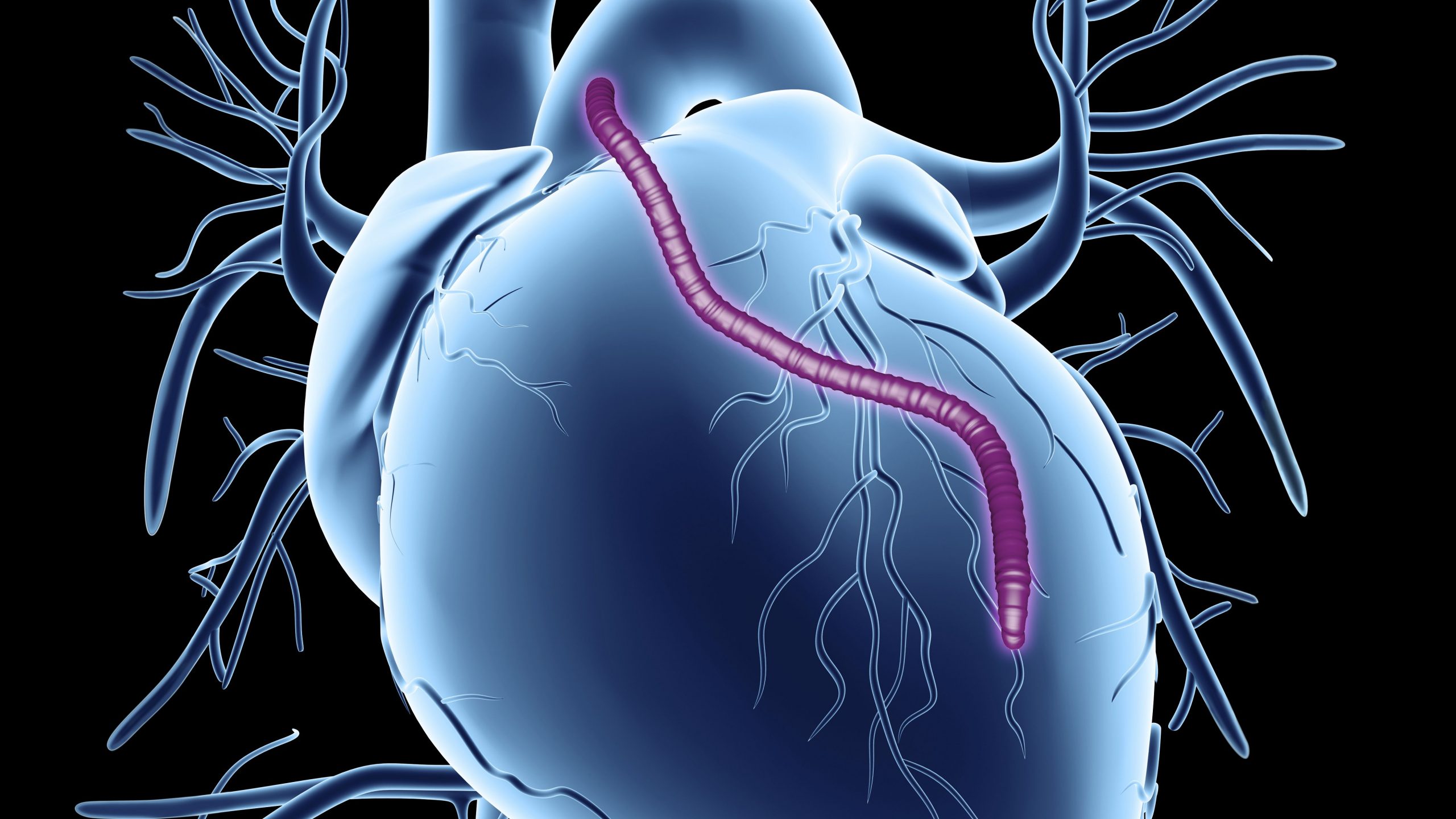 Vascular Graft Market Global Industry Analysis and Forecast (2017-2026)