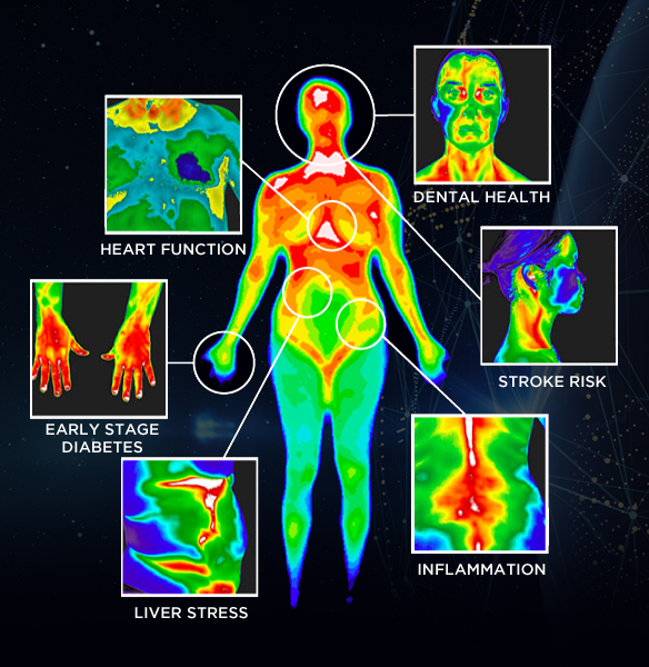 Global Infrared Imaging Market – Global Industry Analysis and Forecast (2017-2026)