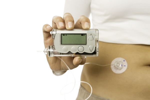 Insulin Pumps Market Register Steady Expansion During 2019-2027 by Insulet Corporation, Medtronic, Tandem Diabetes Care, Debiotech S.A.