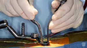 Global Minimally Invasive Spine Surgery Market 2020 – 2026 | Evolving Opportunity With DePuy Synthes, Medtronic