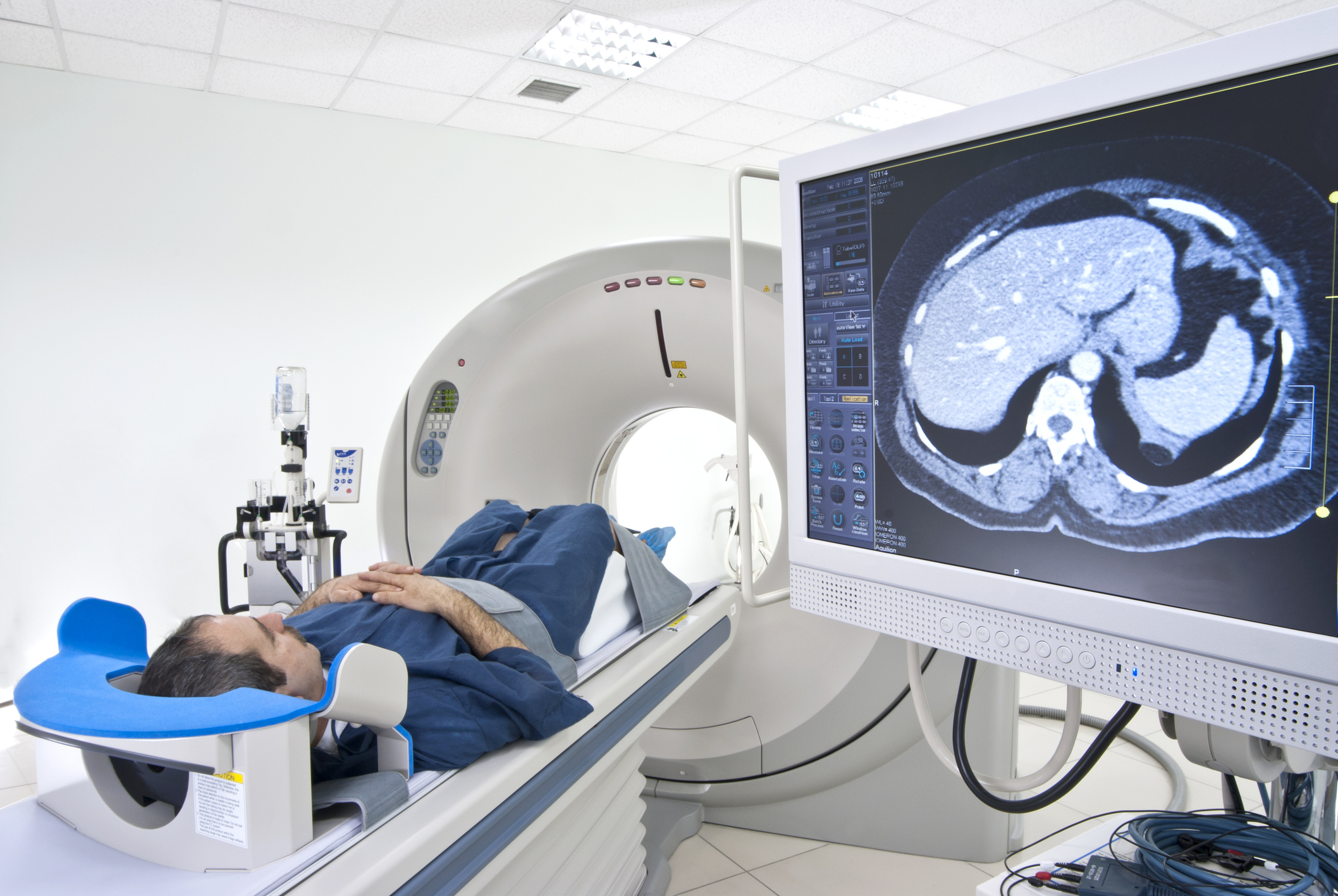 Computed Tomography Ct Scan Market (2020-2027) | Growth Analysis By Siemens (Germany), GE Healthcare (UK), Toshiba (Japan), Hitachi (Japan)