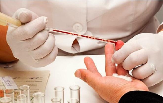 Hematocrit Test Devices Market (2020-2027) | Growth Analysis By Abbott, Roche, Danaher, Bio-Rad