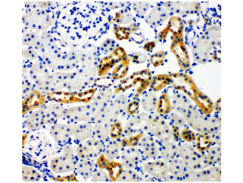 Global NADPH Oxidase 4 Market: In-Depth Insight of Growth And Upcoming Trends, Opportunities 2020 | Bioasis Technologies Inc, GenKyoTex SA
