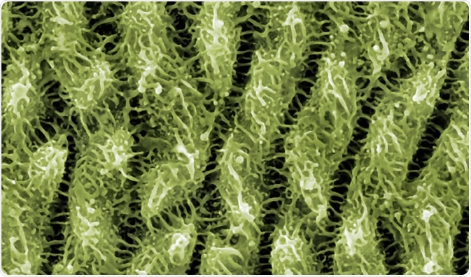 Scanning Probe Microscopy Spm Market (2020-2027) | Growth Analysis By Agilent Technologies, Bruker Nano, Hitachi High-Tech Science Corporation, NT-MDT