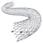 Industry Trend on Global Self Expanding Stents Market | Abbott ...