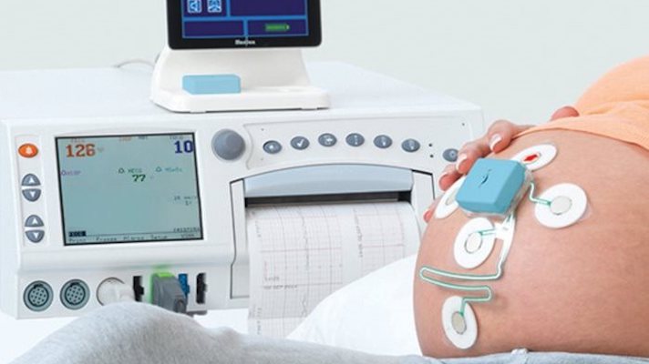 Wireless Fetal Monitoring Systems