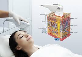 Explore Global High Intensity Focused Ultrasound (HIFU) Market Statistics Analysis & Assessment 2020-2024 | Chongqing Haifu Medical Technology, Philips Healthcare