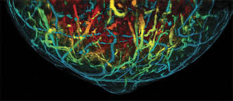 Global Photoacoustic Imaging Market Insights, Industry Expansion Strategies 2020-2024 | iThera Medical GmbH, Seno Medical Instruments