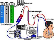 Extracorporeal Membrane Oxygenation Machine Market Companies Overview 2019 – 2027