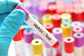 Hemoglobin A1c Testing Market News Research Report 2027