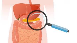 Exocrine Pancreatic Insufficiency (EPI) Therapeutics and Diagnostics Market Compnies Size, Future Trends, Segmentation, Gross Margin, Opportunity Assessment