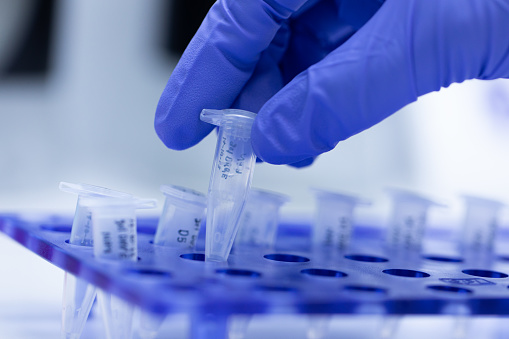 Ubiquitin Proteasome Market Estimated to Flourish by 2024