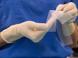 Global Vaginal Mesh Market 2020:  Ethicon, Bard Medical, Endo, Boston Scientific