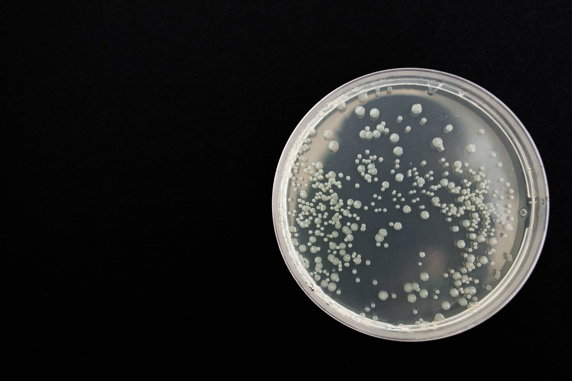 Bacteria on the ISS Survives Three Years in Space