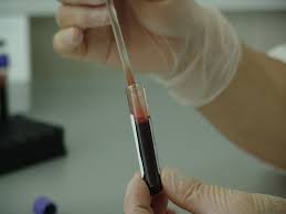 Blood Stream Infection Testing Market