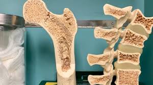 Global Bone Metabolism Tests Market 2020:  Siemens Healthcare GmbH, F Hoffmann-La Roche, Abbott GmbH & Co KG, DiaSorin