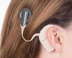 Global Cochlear Implant (CI) System Market 2020- MED-EL, Cochlear, Advanced Bionics (Sonova), Oticon (William Demant), Hangzhou Nurotron