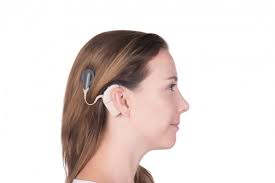 Global Cochlear Implants Market 2020- Cochlear, MED-EL, AB(Sonova), Oticon(William Demant), Nurotron