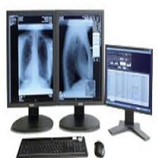 Global Computer Aided Detection System Market 2020- Hologic, Inc., EDDA Technology, Inc., Siemens Healthcare