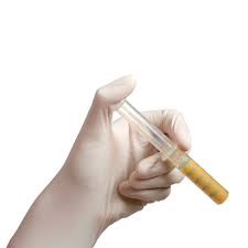 Global Demineralized Allografts Market 2020- Medtronic, J &J (DePuy Synthes), Zimmer, Stryker Corporation, Straumann