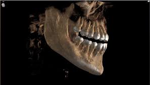Global Dental CBCT Market 2020- Danaher, Planmeca Group, Sirona, New Tom(Cefla), Carestream