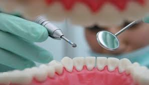 Global Direct Restorative Materials of Dental Consumables Market 2020- 3M ESPE, Dentsply Sirona, Danaher, GC Corporation, Ivoclar Vivadent