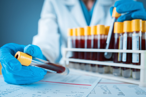 ACTH and GH Function Tests Market Size, Analysis and Forecast up to 2024
